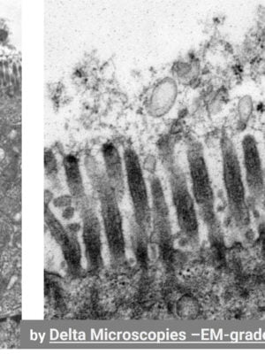 Glutaraldehyde 2% bleu Alcian dans tampon